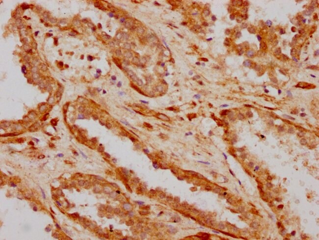 100UL ILDR1 ANTIBODY 100 ul