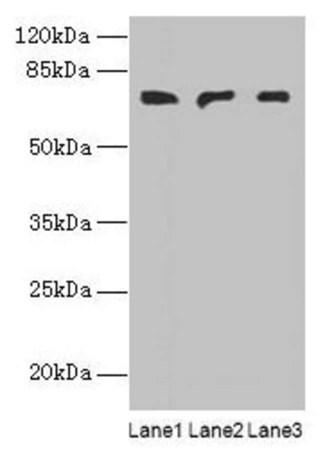 100UG PLCZ1 ANTIBODY 100 ug