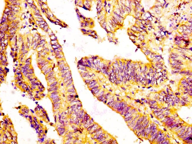 100UG GDF7 ANTIBODY 100 ug