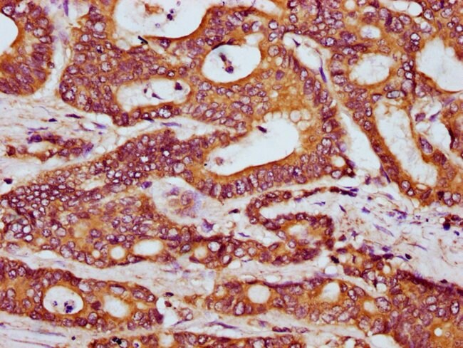 100UG HOOK3 ANTIBODY 100 ug