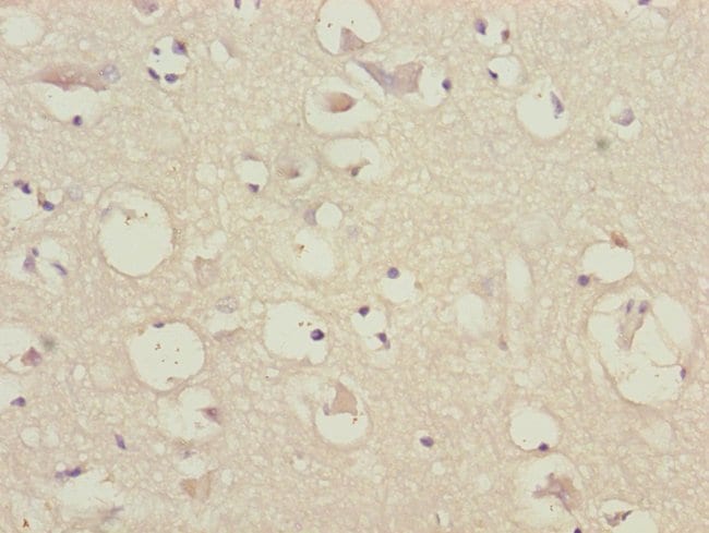 100UL CEP57 ANTIBODY 100 ul