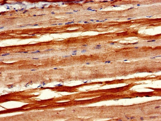 100UG PXK ANTIBODY 100 ug