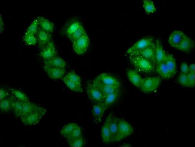 100UG PRUNE ANTIBODY 100 ug