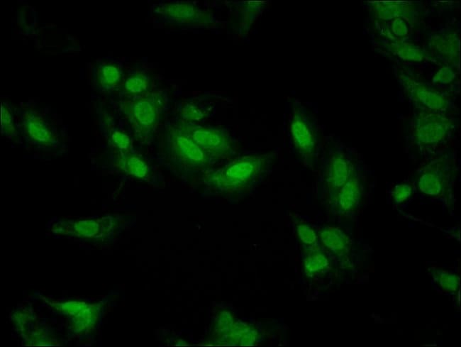 100UG LDB1 ANTIBODY 100 ug