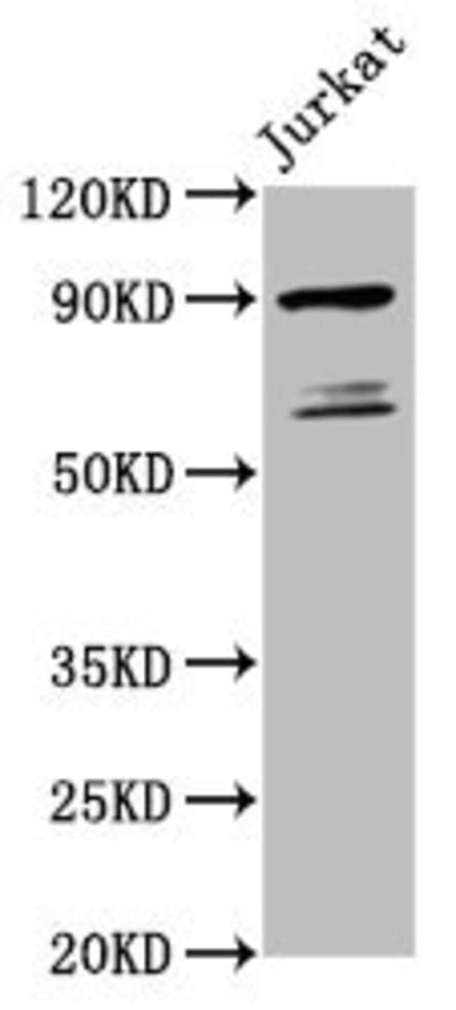 100UG TAX1BP1 ANTIBODY 100 ug