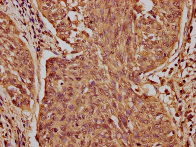 100UG CASZ1 ANTIBODY 100 ug