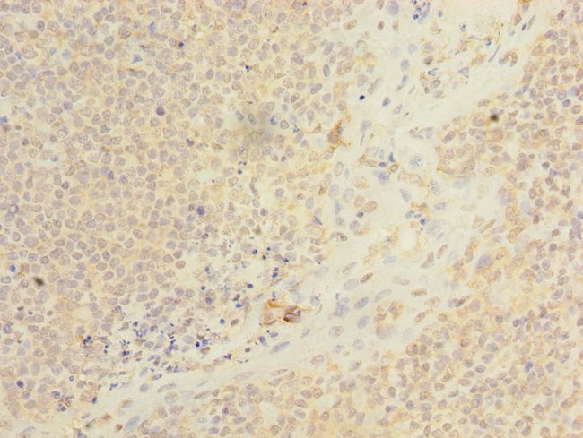 100UG ARMC9 ANTIBODY 100 ug