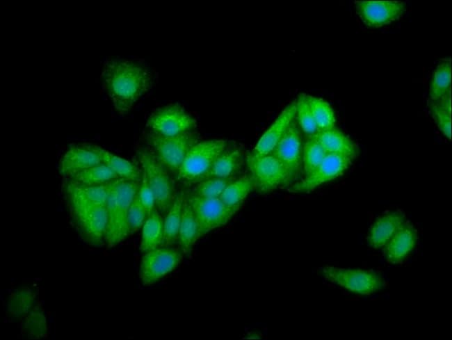 100UG PNPLA5 ANTIBODY 100 ug