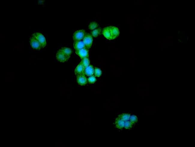 100UG ATG4D ANTIBODY 100 ug