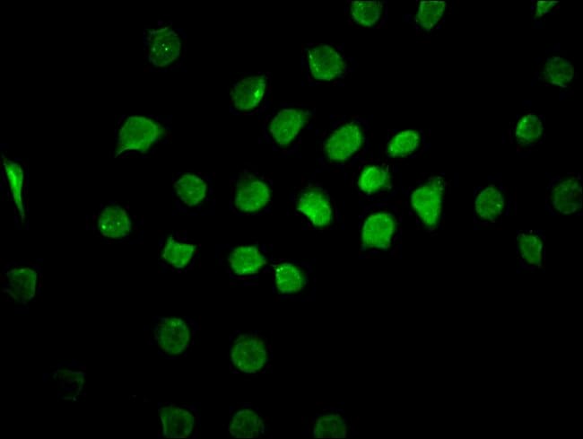 100UG CAND1 ANTIBODY 100 ug