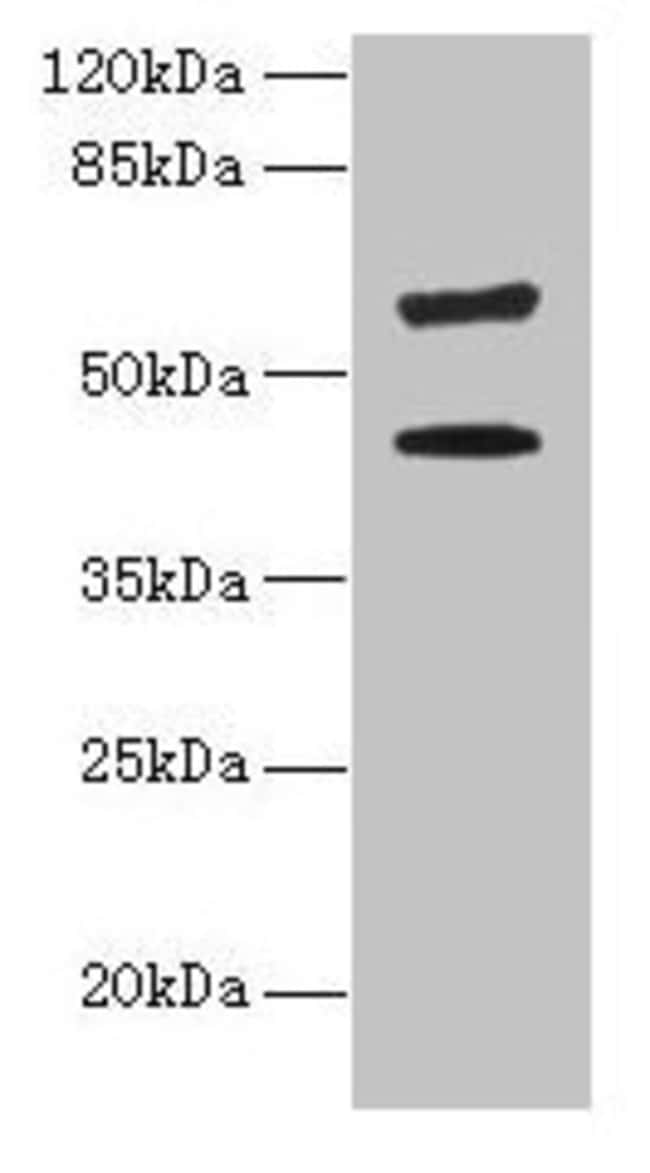 100UG KRT73 ANTIBODY 100 ug