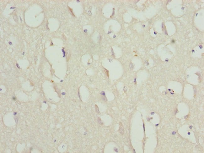 100UL ANILLIN ANTIBODY 100 ul