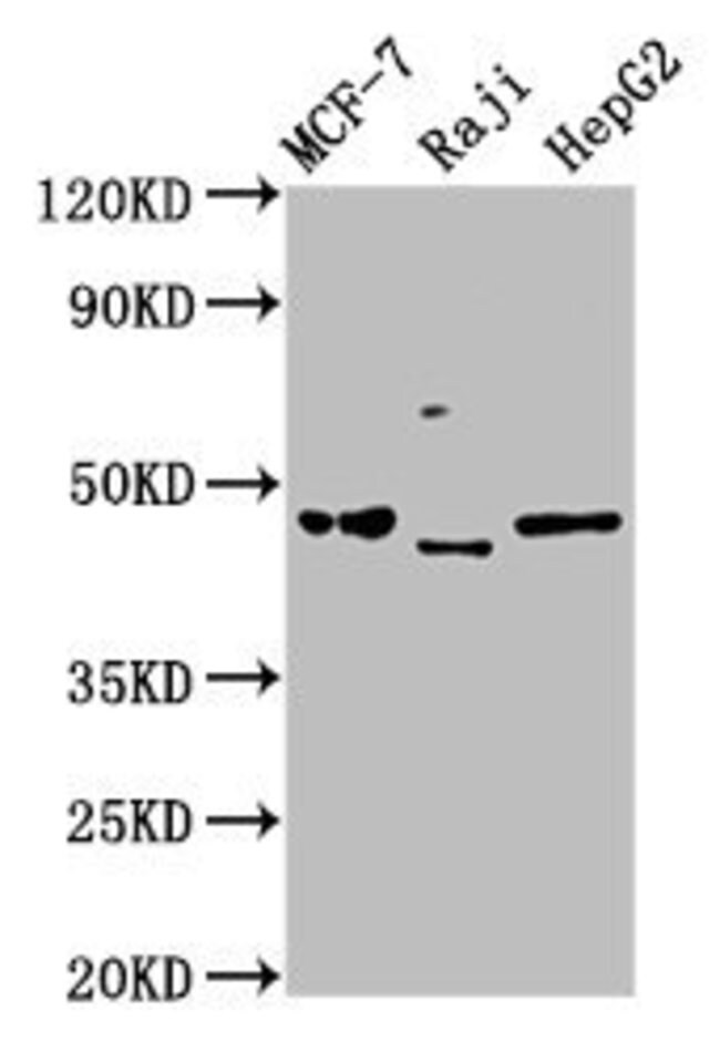 100UG SERPINA11 ANTIBODY 100 ug