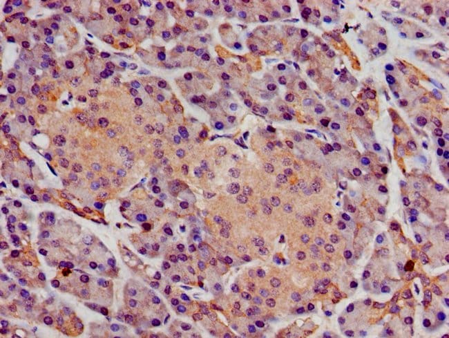 100UG SGMS1 ANTIBODY 100 ug