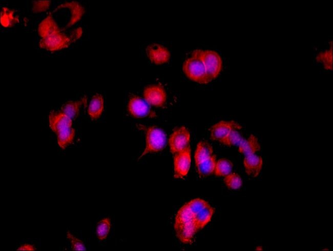 100UG LDHD ANTIBODY 100 ug