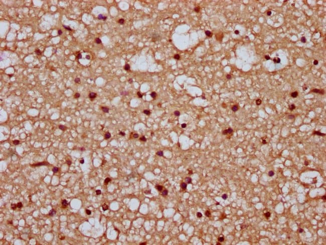 100UG TIPARP ANTIBODY 100 ug