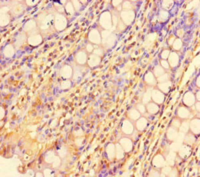 100UG ZBTB46 ANTIBODY 100 ug