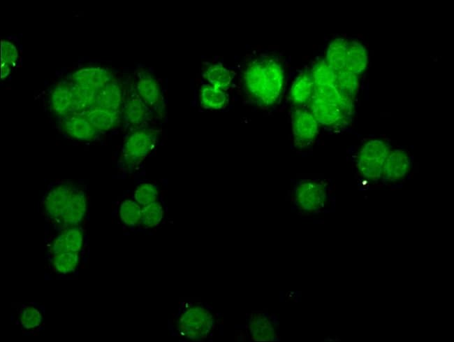 100UG CHD1L ANTIBODY 100 ug