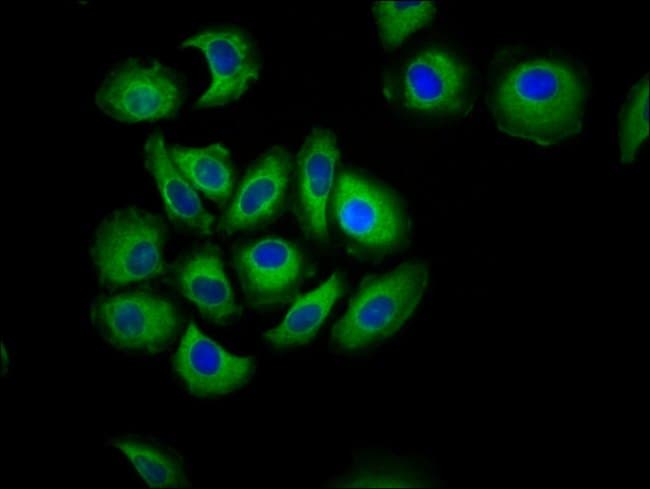 100UG CDH7 ANTIBODY 100 ug
