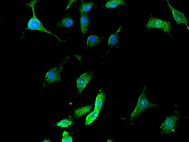 100UG SEPT12 ANTIBODY 100 ug