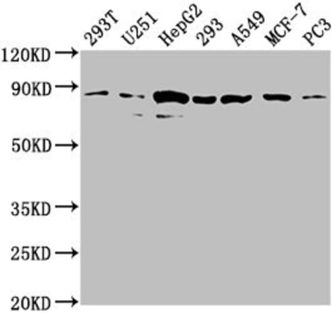 100UL AMOTL2 ANTIBODY 100 ul