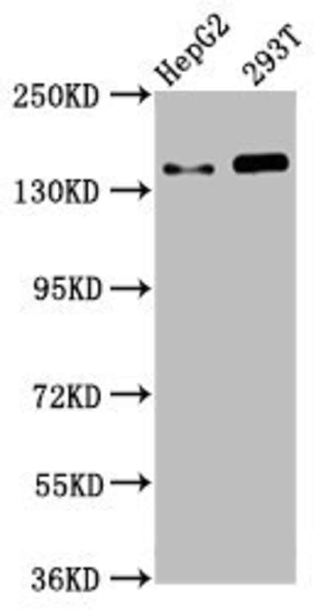 100UG SMC5 ANTIBODY 100 ug