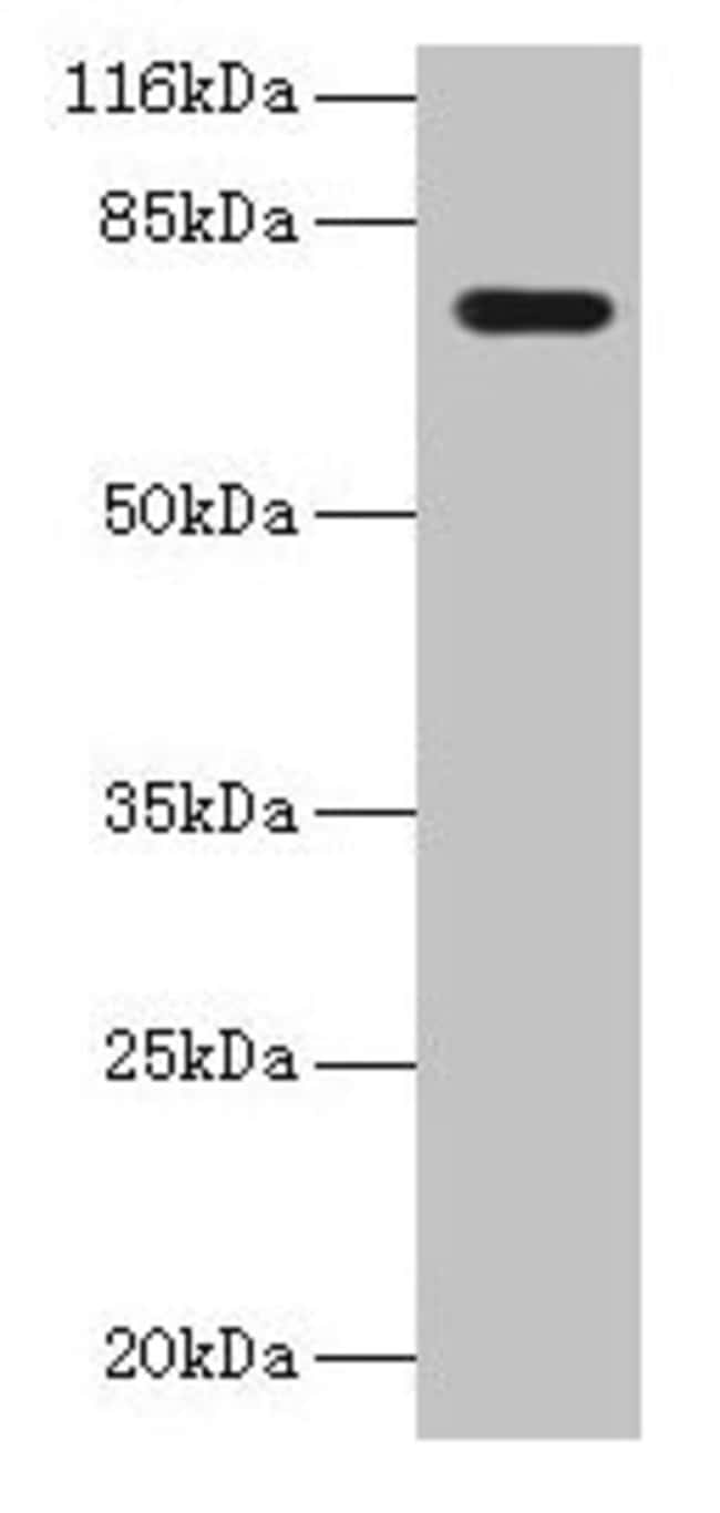 100UG KBTBD2 ANTIBODY 100 ug
