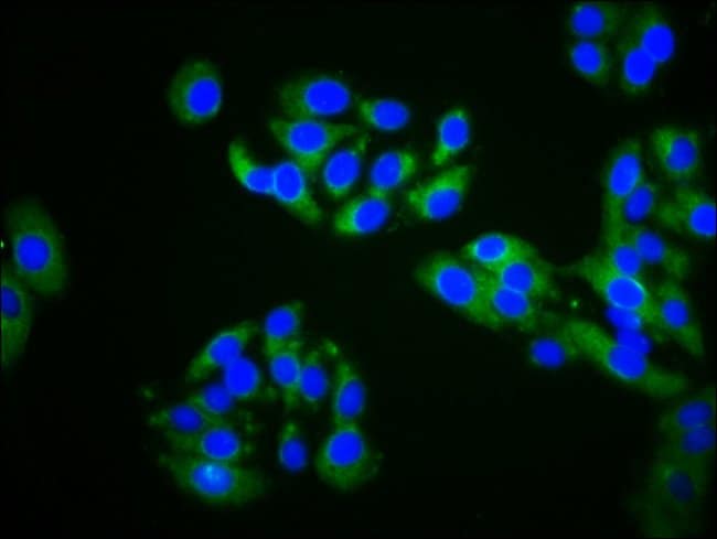 100UG ZDHHC14 ANTIBODY 100 ug