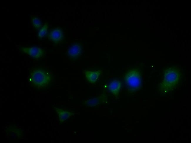 100UG MMD2 ANTIBODY 100 ug