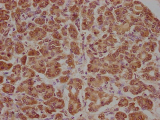 100UL APCDD1 ANTIBODY 100 ul
