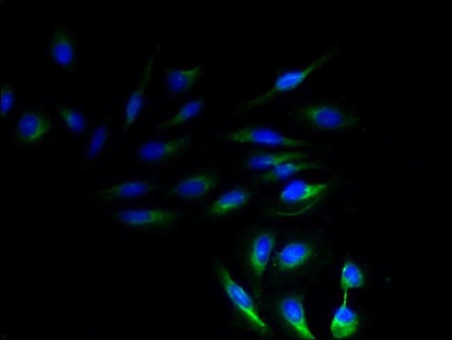 100UG NRSN1 ANTIBODY 100 ug