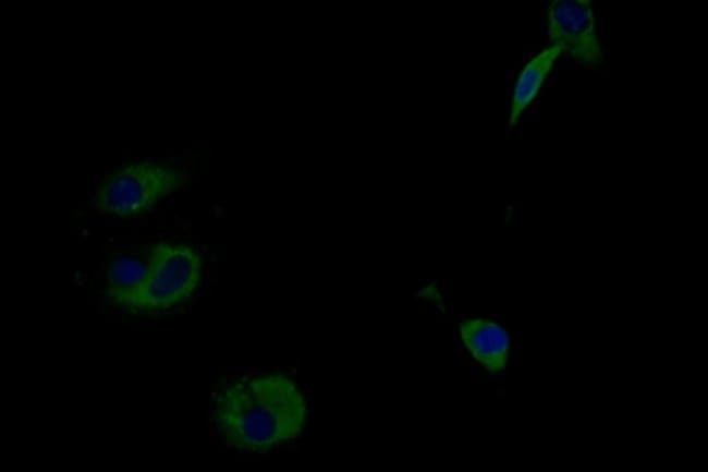 100UL IFNLR1 ANTIBODY 100 ul