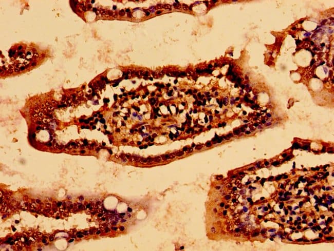 100UG HSCB ANTIBODY 100 ug