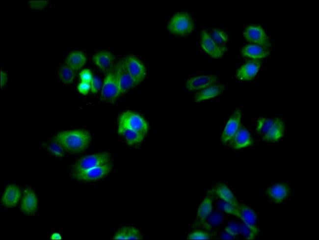 100UG ARCH ANTIBODY 100 ug