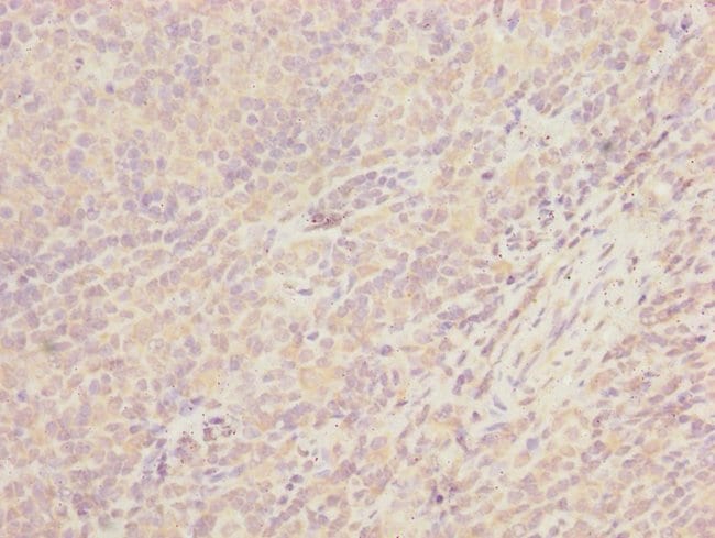 100UL CEP57L1 ANTIBODY 100 ul