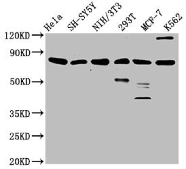 100UL KMT2E ANTIBODY 100 ul