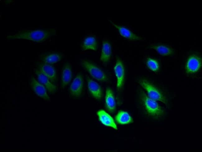 100UG JAGN1 ANTIBODY 100 ug
