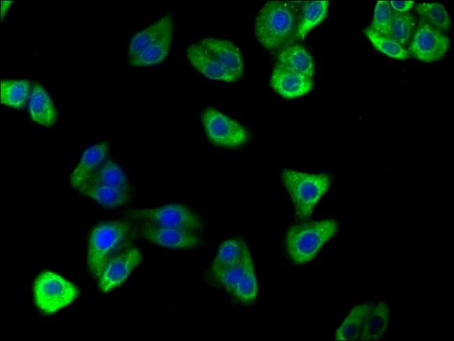 100UL ATP6V0D2 ANTIBODY 100 ul