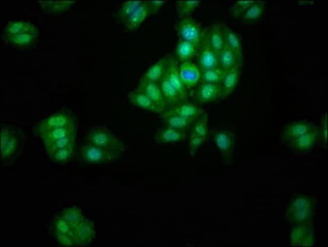 100UG LACE1 ANTIBODY 100 ug