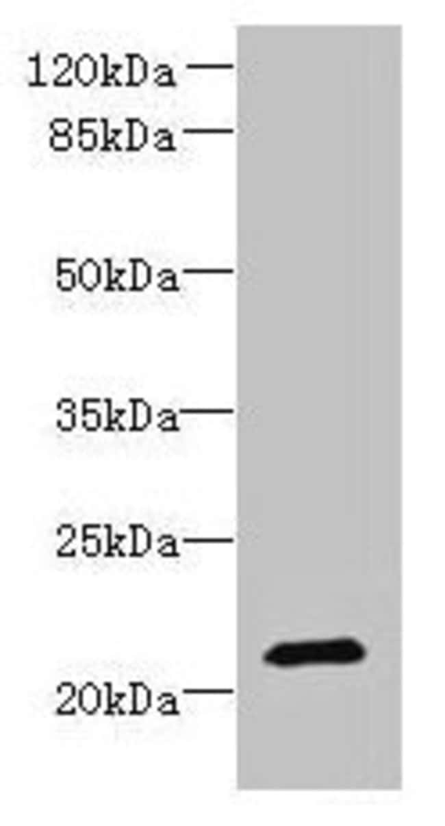 100UG DYDC1 ANTIBODY 100 ug