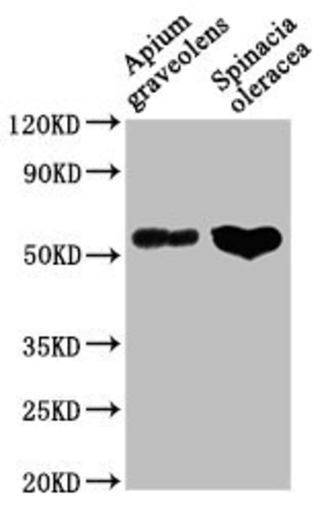 100UL CATALASE-1 ANTIBODY 100 ul