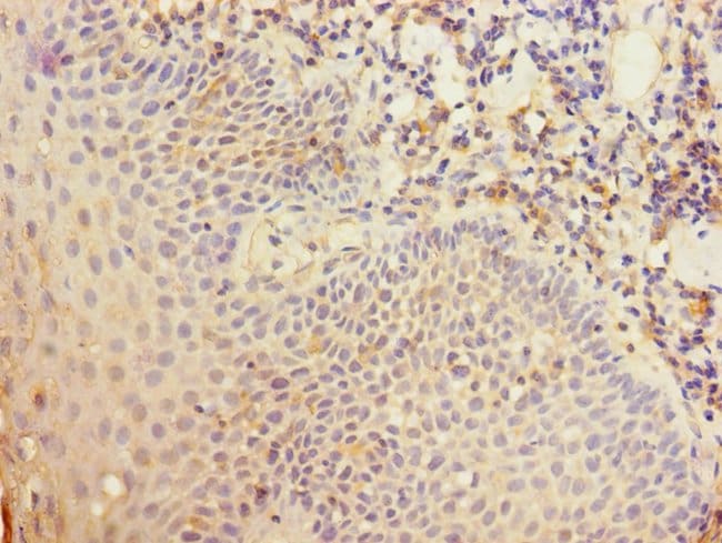 100UL CD35 ANTIBODY 100 ul