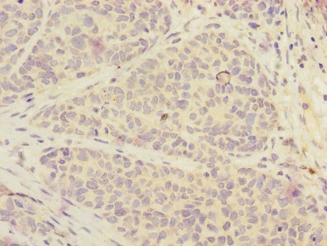 100UL FOXRED1 ANTIBODY 100 ul