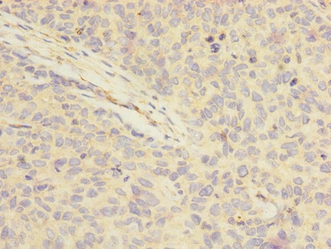 100UL FOXRED1 ANTIBODY 100 ul
