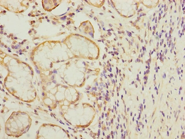 100UL MTERFD1 ANTIBODY 100 ul