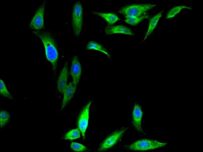 100UG DAZAP1 ANTIBODY 100 ug
