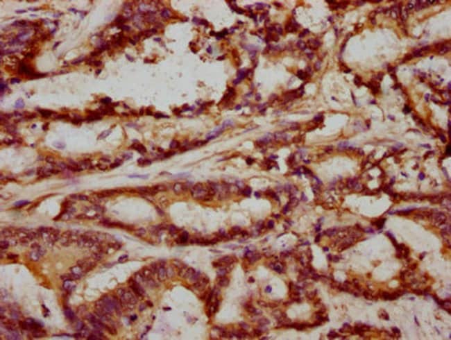100UL FRMD6 ANTIBODY 100 ul