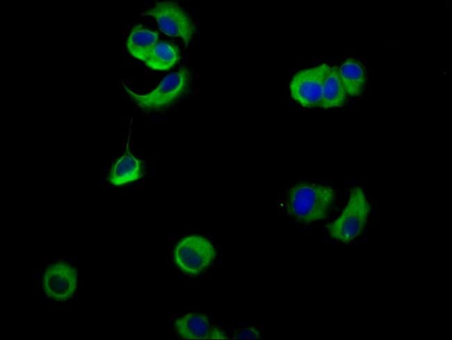 100UG NECTIN 4 ANTIBODY 100 ug