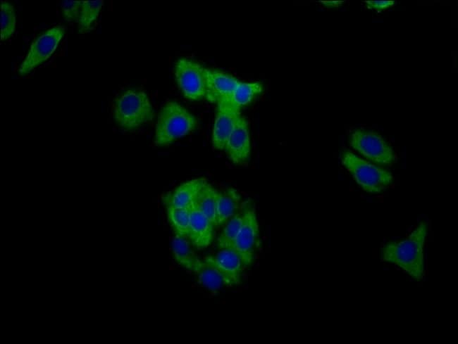 100UG MUC20 ANTIBODY 100 ug