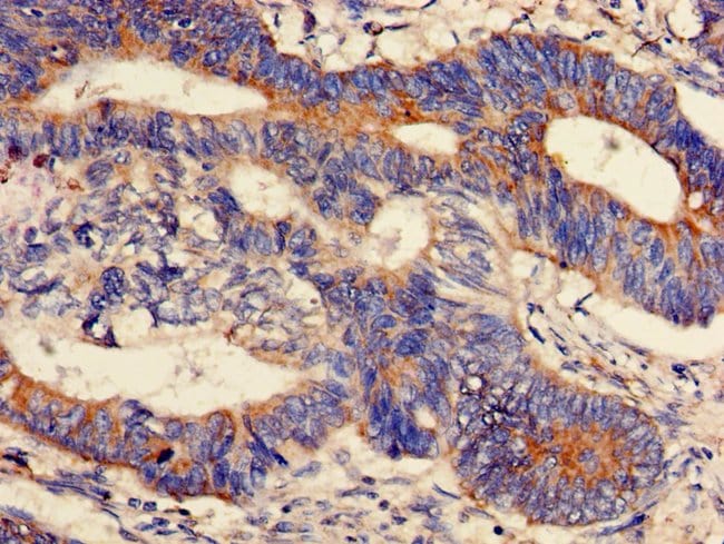 100UG PPM1K ANTIBODY 100 ug